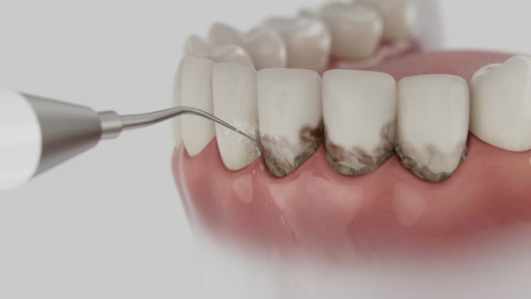 Reliable Dental Implants contractor in Redfield, AR by Smile Center Dentistry
